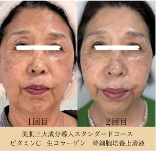 谷九上本町REINE YUKIのエステ・リラクイメージ