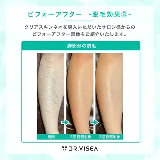 プライベートサロン Avenirのエステ・リラクイメージ