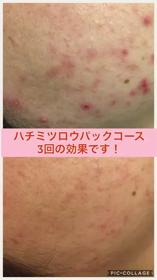 ショート カラー パーマ ヘアアレンジ メンズ キッズ ネイル マツエク・マツパ ニキビ・肌質改善専門 ♡人生が変わるサロンのエステ・リラクイメージ