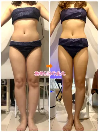 ショート カラー パーマ ヘアアレンジ メンズ キッズ マツエク・マツパ ‍痩身＆ボディ 結果出し🌟丹野のエステ・リラクイメージ