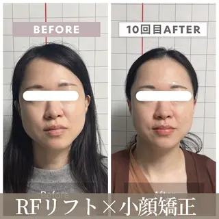 小顔矯正専門店 【RED】池田のエステ・リラクイメージ