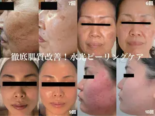 MYubelle ミューベルのエステ・リラクイメージ