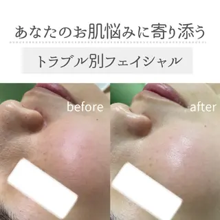 デ・アイム新潟北所属・サイトウ .のエステ・リラクイメージ