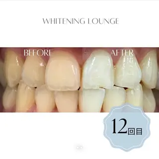 ホワイトニングラウンジ横須賀所属・ホワイトニング Lounge横須賀のその他イメージ
