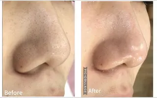 アンジェリック ビーナス　Rinonのエステ・リラクイメージ