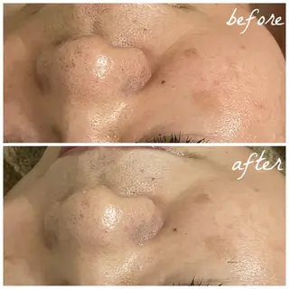 メンズ メナード岐阜茜部 杉浦のエステ・リラクイメージ