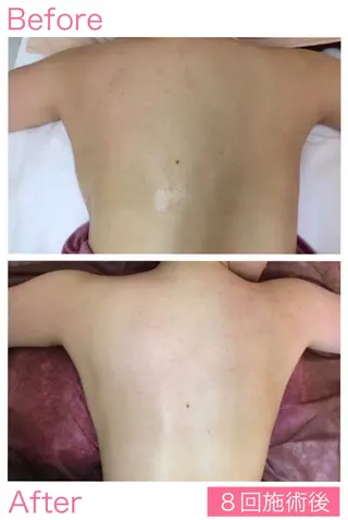 Lov. it ﾗｳﾞｨｯﾄのエステ・リラクイメージ