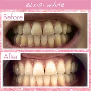 ホワイトニングサロンLuana-Sinfonia(エクシア)池袋店所属・セルフホワイトニング エクシア 池袋店のその他イメージ