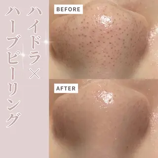 プライベートサロン Belle(ベル)のエステ・リラクイメージ