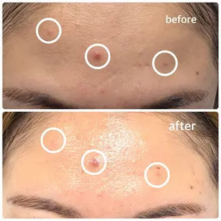 今西 彩夢のエステ・リラクイメージ