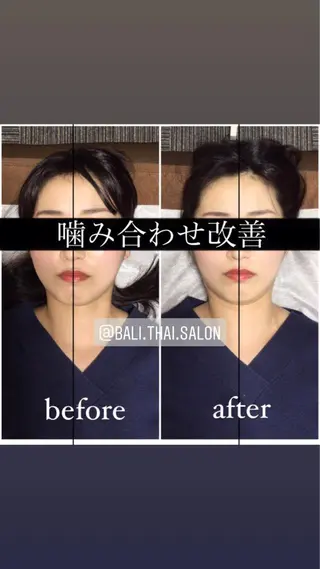 🌈歪み改善🌈 バリンタイ すぎうらのエステ・リラクイメージ