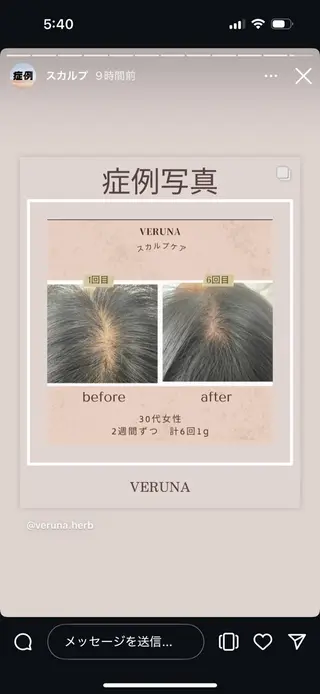 メンズ Grandir所属・ハーブピーリング専門 グランディール　武内のエステ・リラクイメージ