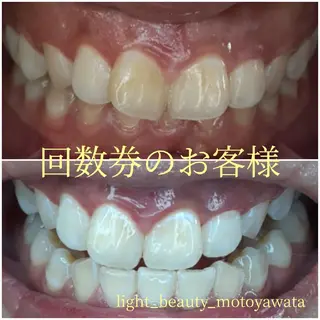 五十嵐 蓮のその他イメージ