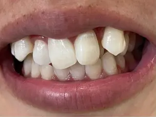 セルフホワイトニングサロン　ラヴィアン所属・ホワイトニングサロン La vie enのその他イメージ