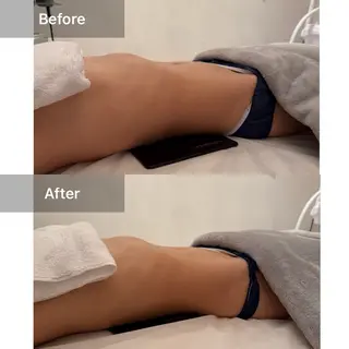 ハーブピーリング✨ 🌿最強痩身🔥のエステ・リラクイメージ