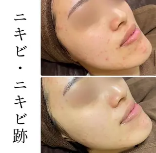 ハーブピーリング専門 BIOPLUS＋川崎のエステ・リラクイメージ