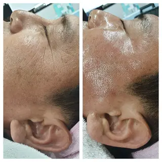 小顔専門看護師クリニカルサロンCOCO所属・小顔と美肌サロン クリニカルサロンココのエステ・リラクイメージ