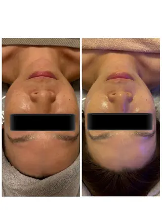 esthesalon Ran所属・小顔美肌痩身サロン Ranのその他イメージ