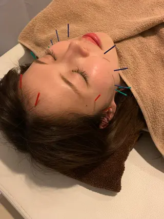 小林整骨院本町 美容鍼roomのエステ・リラクイメージ