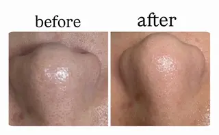 Salon【yuzu.】所属・🍊肌管理×美眉 【yuzu.】の眉毛・アイブロウイメージ