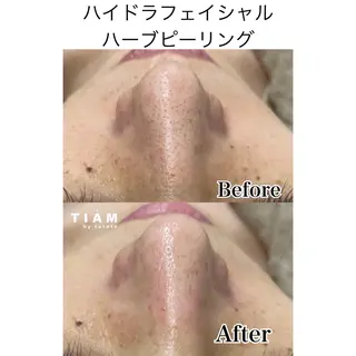 美肌サロンTIAM by tetoteのエステ・リラクイメージ