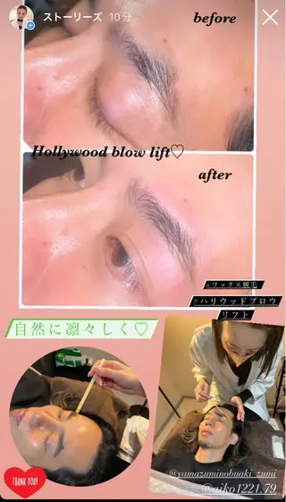 アイブロウ ハーブピーリング/韓国肌管理/フェイシャル/毛穴洗浄/眉毛/顔脱毛【糸脱毛専門】rev所属・ハーブピーリング🌹 毛穴洗浄❤️眉waxのエステ・リラクイメージ