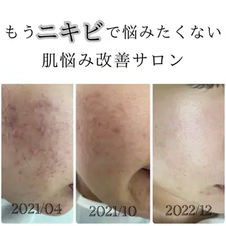 デ・アイム新潟北所属・サイトウ .のエステ・リラクイメージ