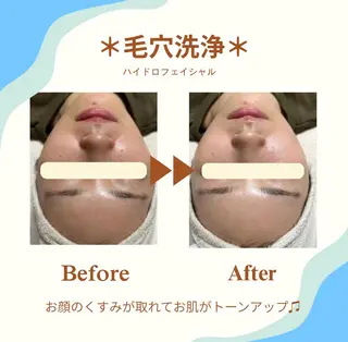 White labo 今村のエステ・リラクイメージ