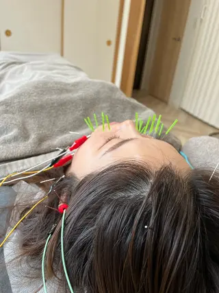 ReNEW鍼灸整骨院所属・美容鍼・小顔矯正・ 整体/神戸　RYOのエステ・リラクイメージ