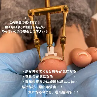 Estotibi エストティビのその他イメージ