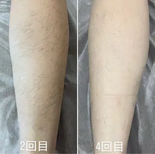 てらもと ほのかのエステ・リラクイメージ