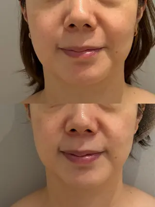 Hair&Spa リーノ所属・折原 あやのエステ・リラクイメージ