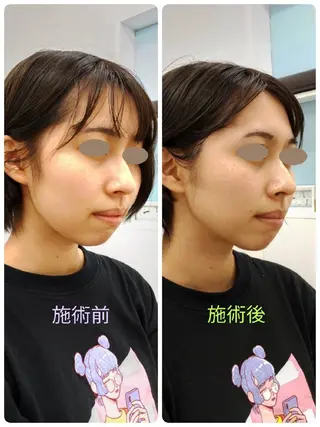 CORAL湘南平塚店所属・【小顔・美容専門】 🐠リカのエステ・リラクイメージ