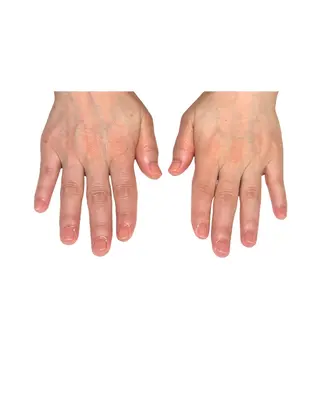 ネイル 深爪矯正専門店ネイルサロンKUU所属・ネイルサロン KUUのネイルデザイン