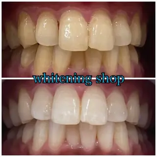 ホワイトニングショップせんげん台店所属・スタッフ 兎洞のその他イメージ