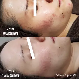 Salon b.p. 渋谷のエステ・リラクイメージ