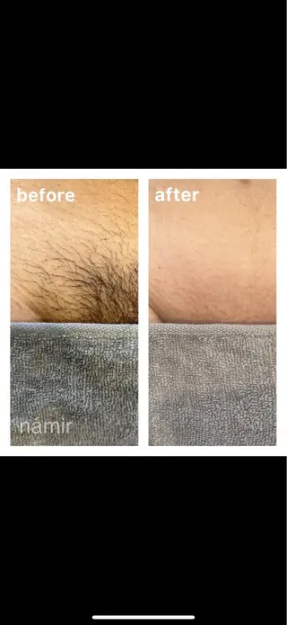 ブラジリアンワックス＋光脱毛専門店námir【ナミル】所属・ブラジリアンワックス ＆光脱毛námirのエステ・リラクイメージ