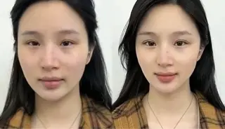 ネイル aliaハイフ&水光ジェットサロン所属・aliaハーブ水光店 エステティシャン募集のエステ・リラクイメージ