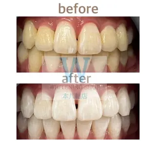 ホワイトニング ショップ本八幡店のエステ・リラクイメージ