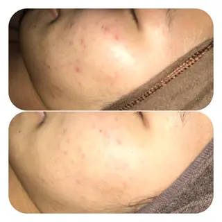 【足圧】鬼👹リンパ 身体整うサロンのエステ・リラクイメージ