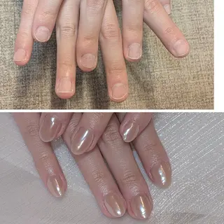 ネイル ネイリストゆか💅 長さだし、深爪矯正のネイルデザイン