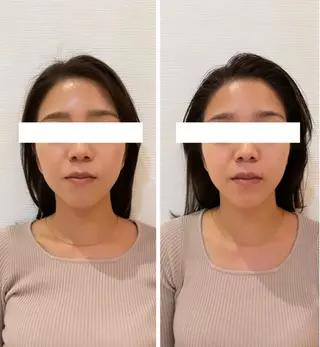 自律神経を整える フェイシャルエステのエステ・リラクイメージ