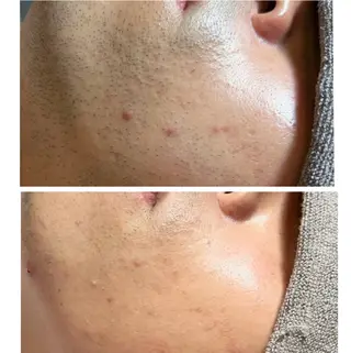 メンズ JOLF salon originalのエステ・リラクイメージ