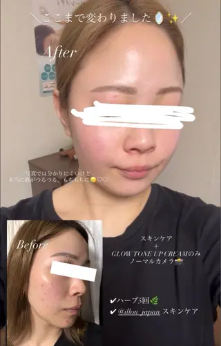 Luca所属・Luca ﾙｶのエステ・リラクイメージ