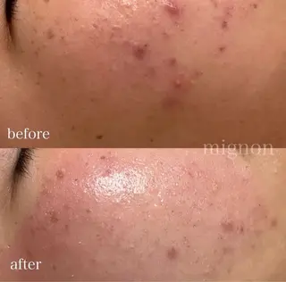 、 、‪‪のエステ・リラクイメージ