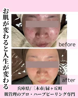 ハーブピーリング 専門／今榮麻美のエステ・リラクイメージ