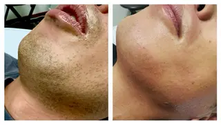 メンズ Lumus Solarum所属・Lumus Solarumのエステ・リラクイメージ