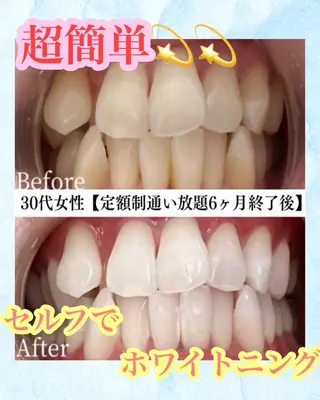 メンズ キッズ ホワイトニング専門店 WHITE天神店のエステ・リラクイメージ