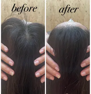 ate'所属・個室ドライヘッドスパ 🍃moriのエステ・リラクイメージ