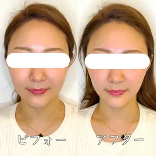 小顔矯正&美容整体 整え屋REDオーナーのエステ・リラクイメージ